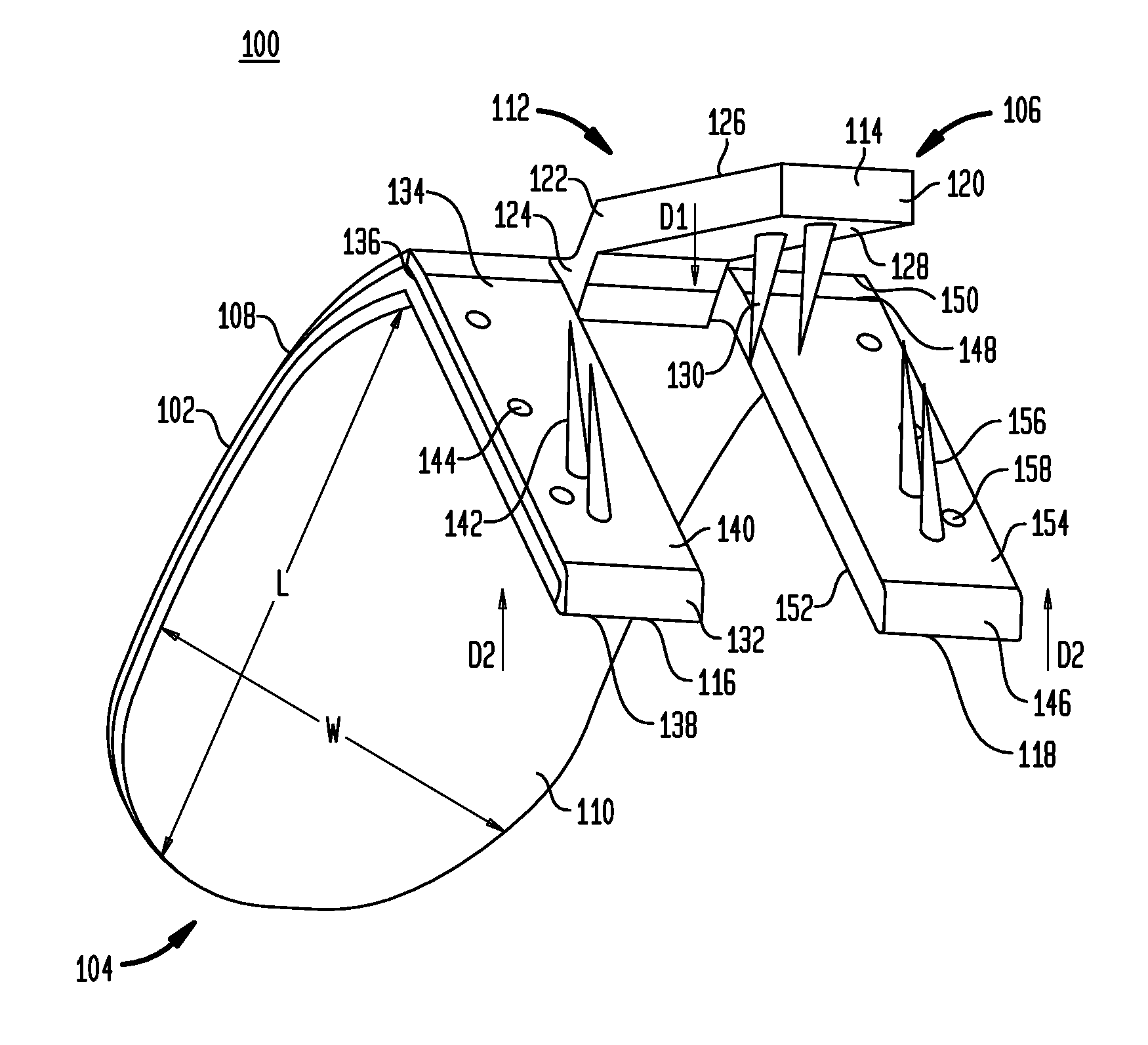 Implant systems and methods for treating obstructive sleep apnea