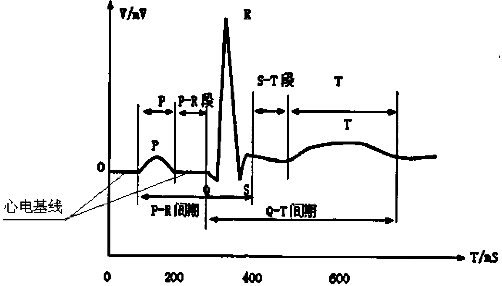 Method and device for calibrating R wave of electrocardiosignal