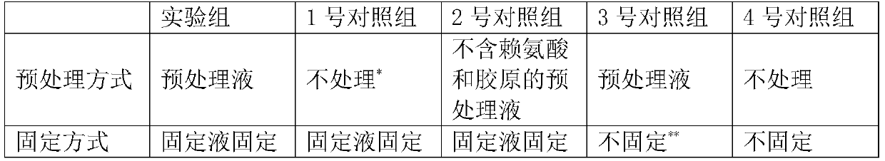 Method for preparing freeze-dried platelets and application thereof