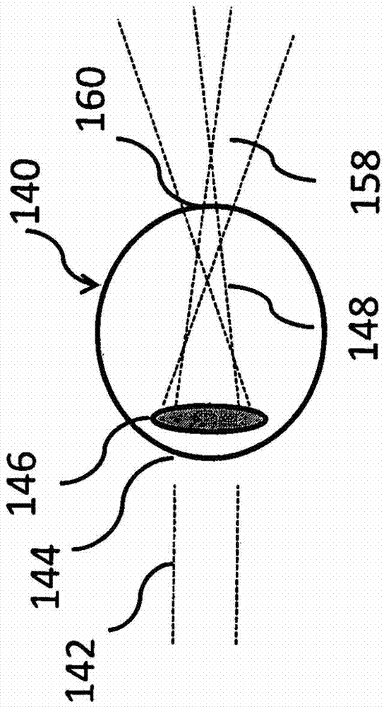 Lenses, devices, methods and systems for refractive error