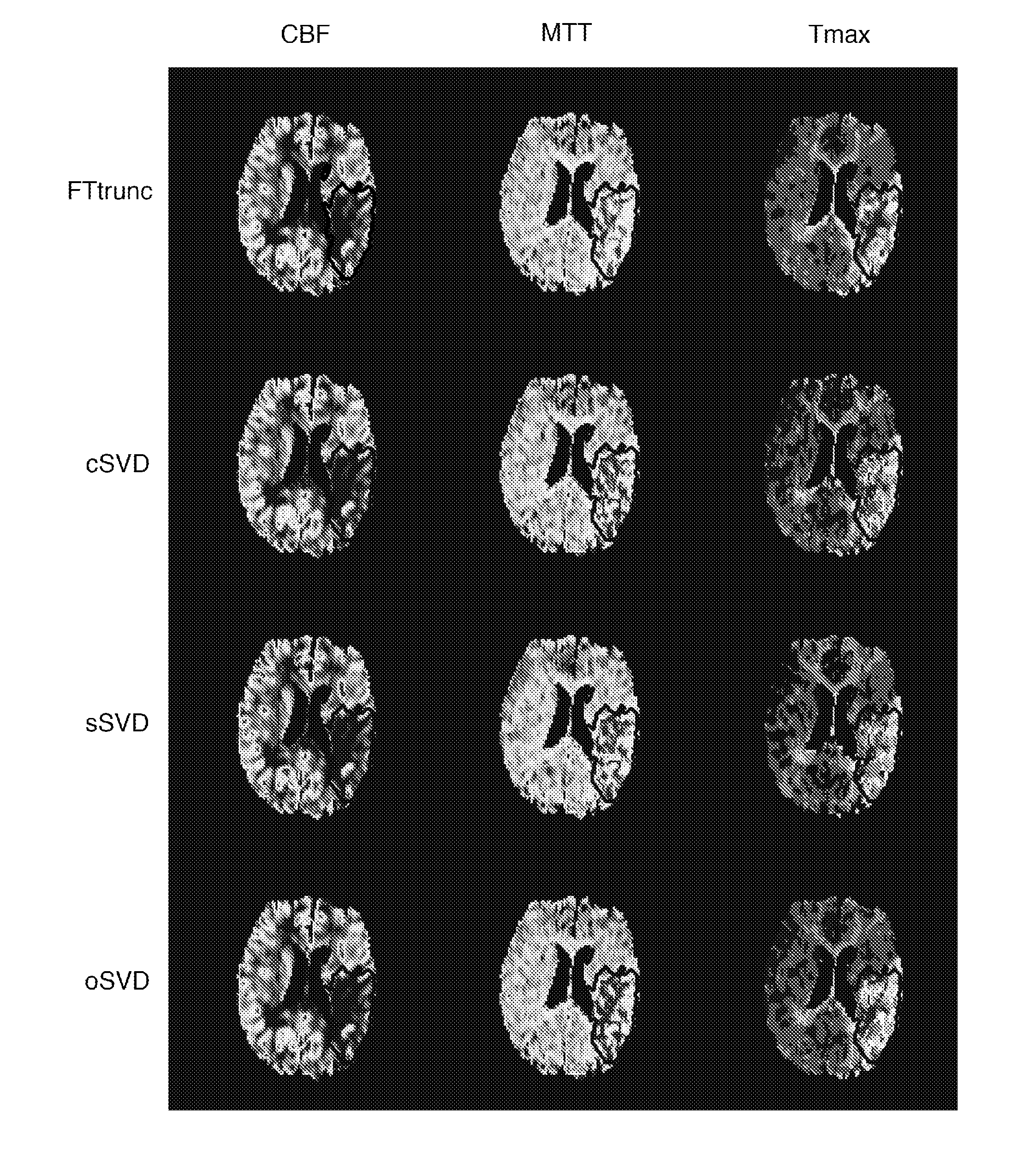 Method for obtaining a blood flow parameter