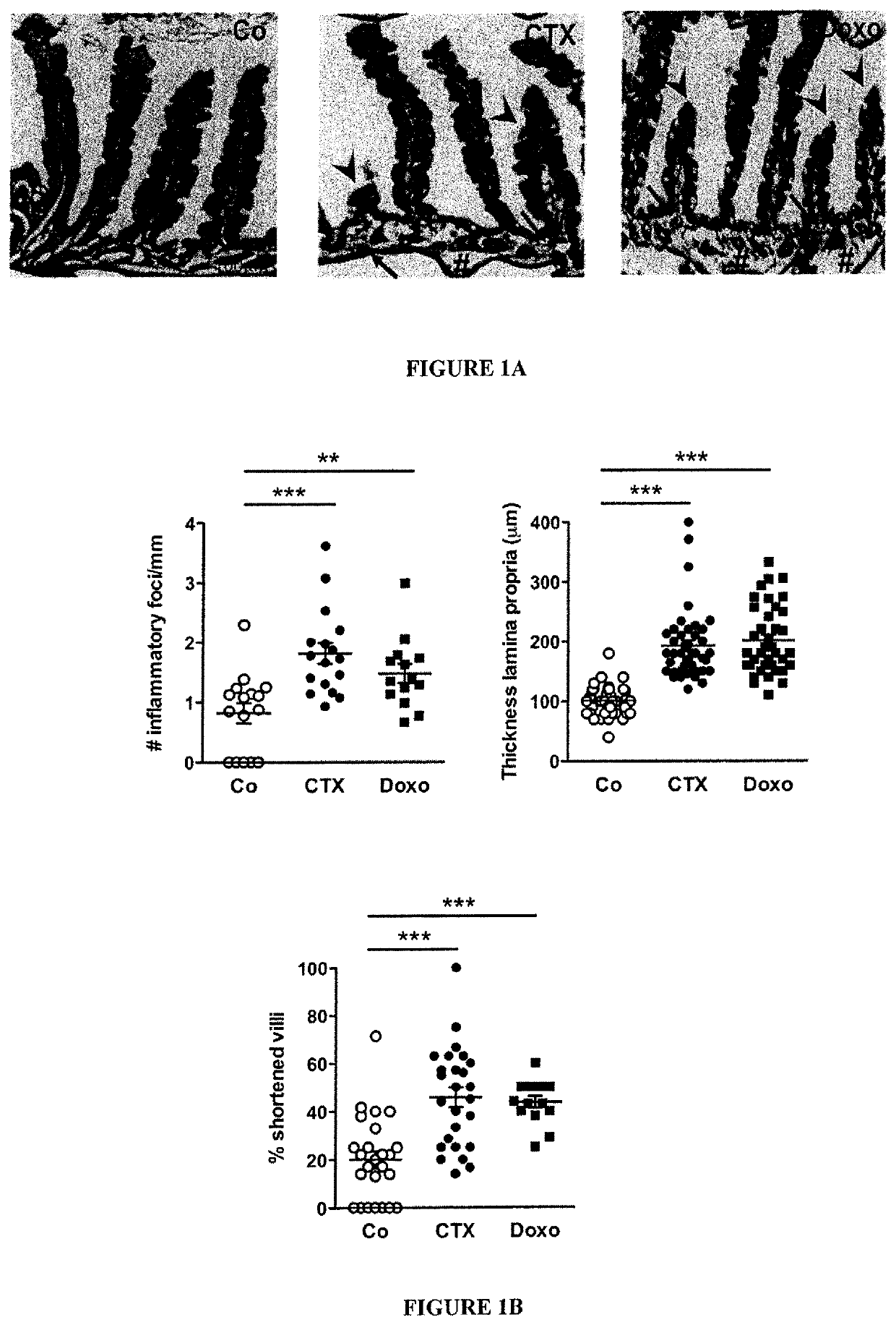 Microbiota composition, as a marker of responsiveness to chemotherapy, and use of microbial modulators (pre-, pro- or synbiotics) for improving the efficacy of a cancer treatment