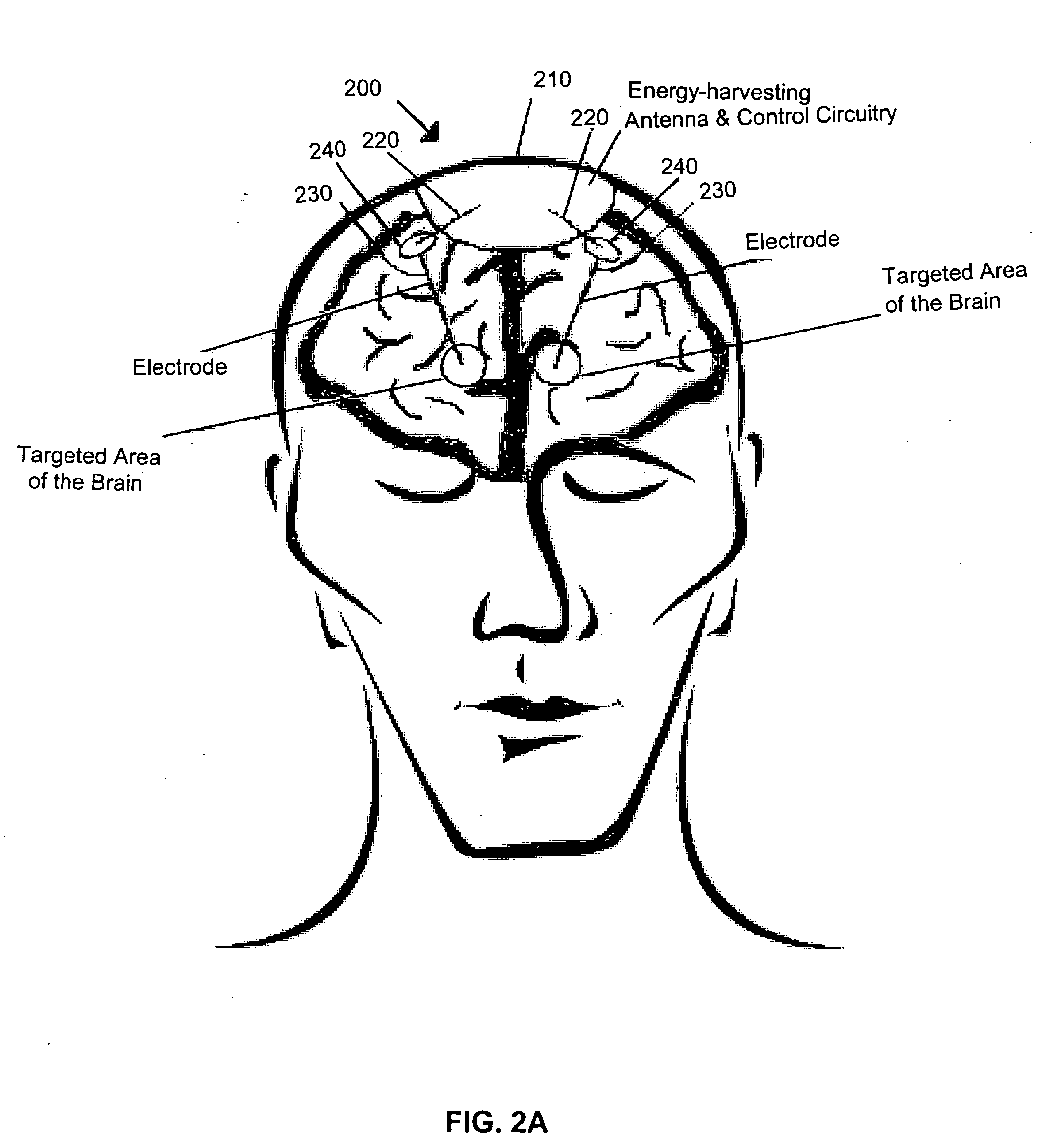 Device for brain stimulation using RF energy harvesting