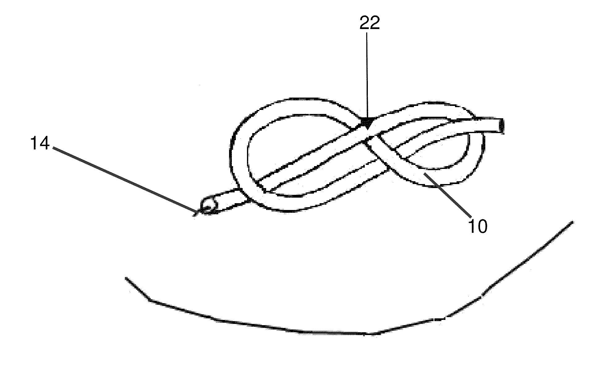 Patient safety and wellbeing device for covering wires and needles used in mammography or ultrasound guided needle localization