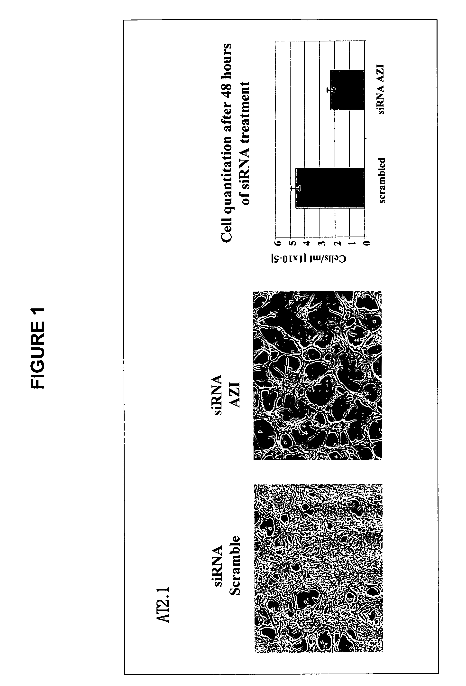 Methods for the treatment, diagnosis, and prognosis of cancer