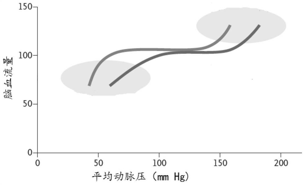 Cerebral blood flow autonomous regulation ability assessment method