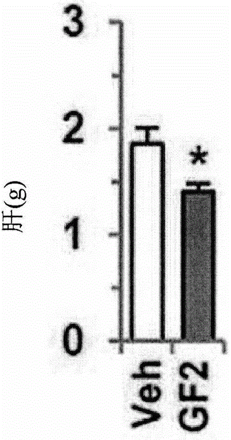 Composition for preventing or treating non-alcoholic liver disease or insulin resistance comprising ginsenoside F2