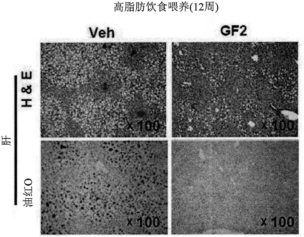 Composition for preventing or treating non-alcoholic liver disease or insulin resistance comprising ginsenoside F2