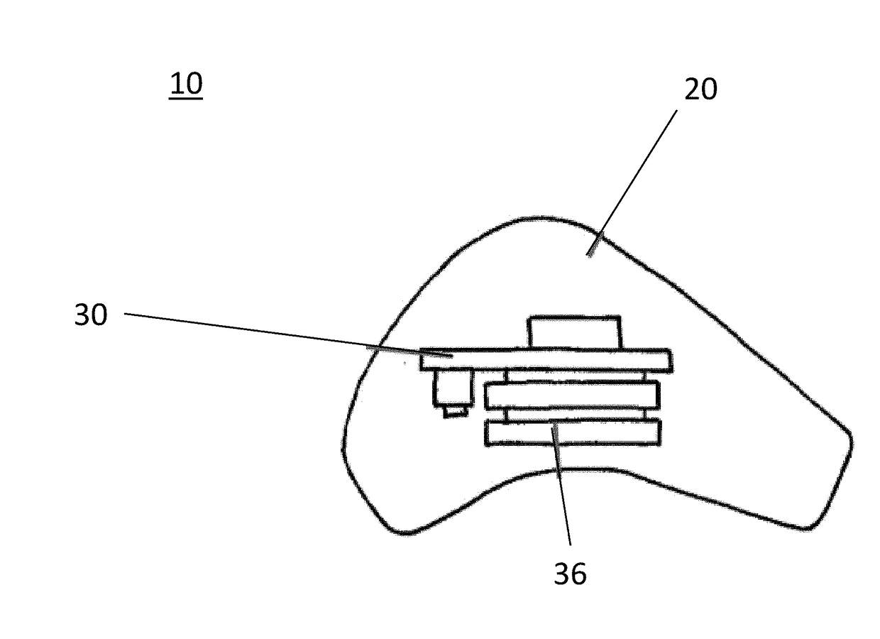 Systems and devices for proactively influencing brainwaves