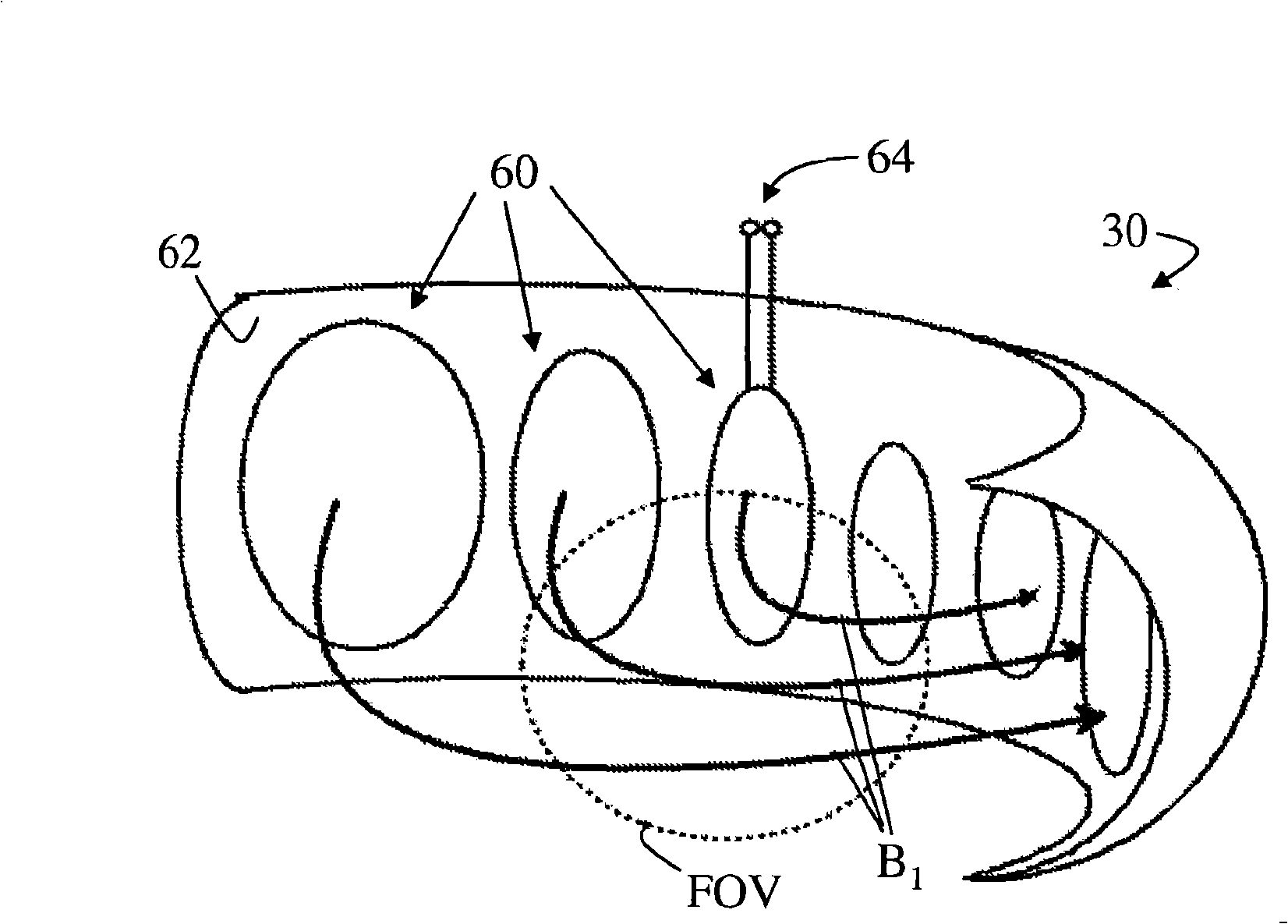 Non-cylindrical RF coil for MRI