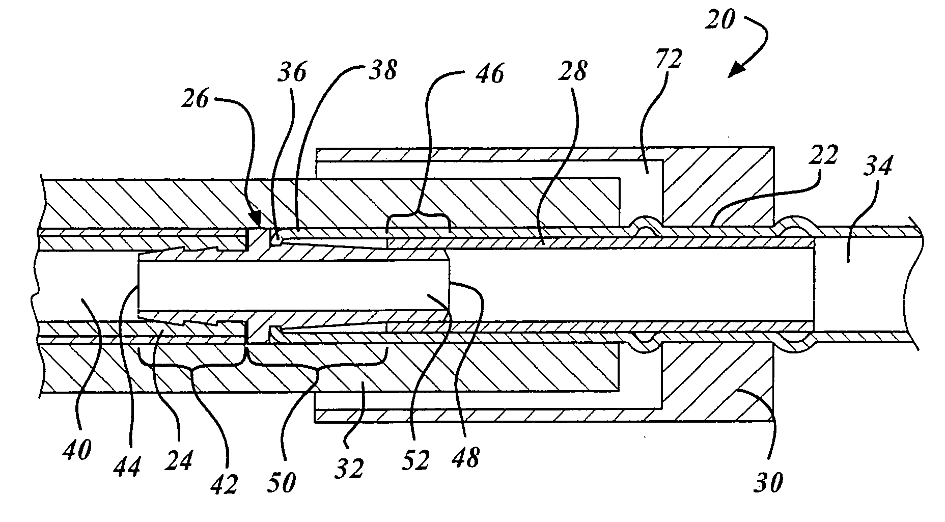 Tuning cable to pressure body connector