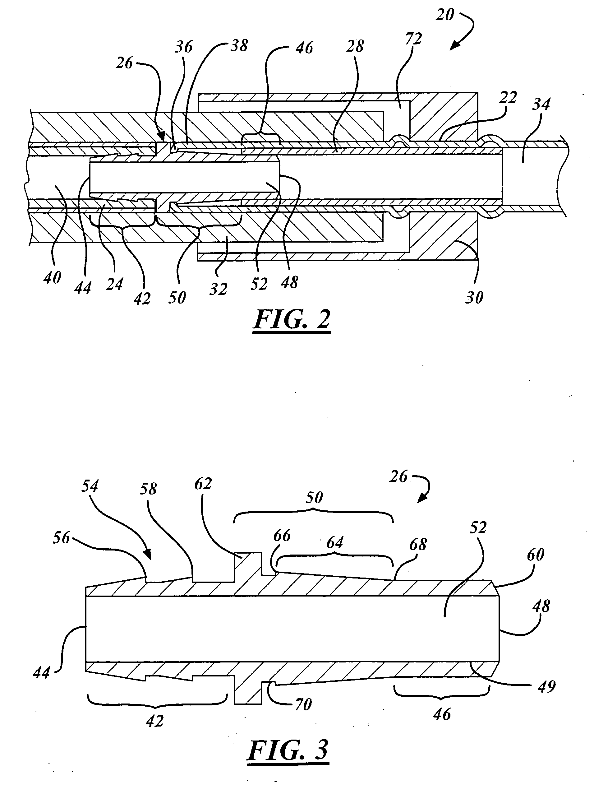 Tuning cable to pressure body connector