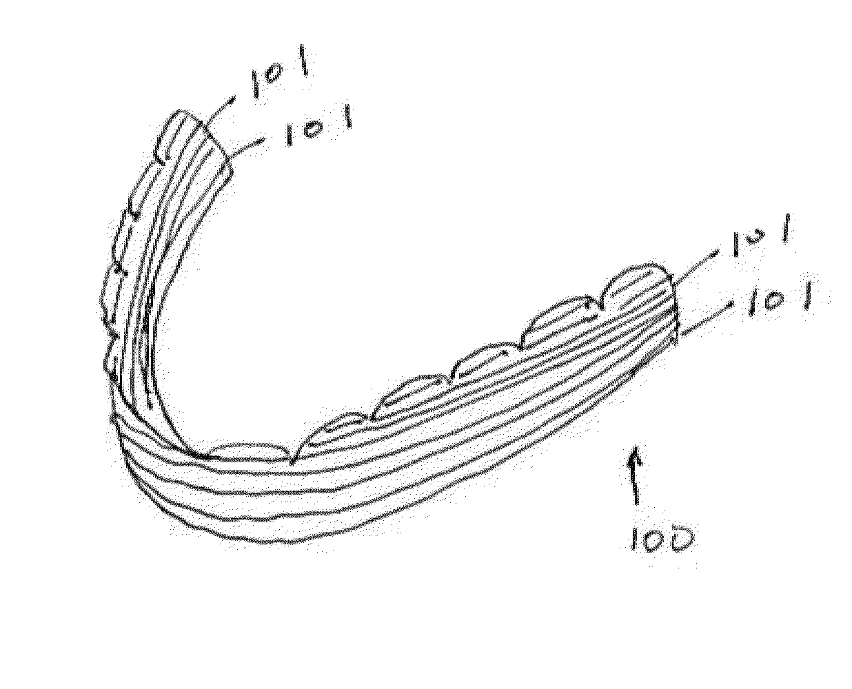 Orthodontic aligners, methods of using such aligners, and additive manufacturing methods and apparatus for making and using such aligners