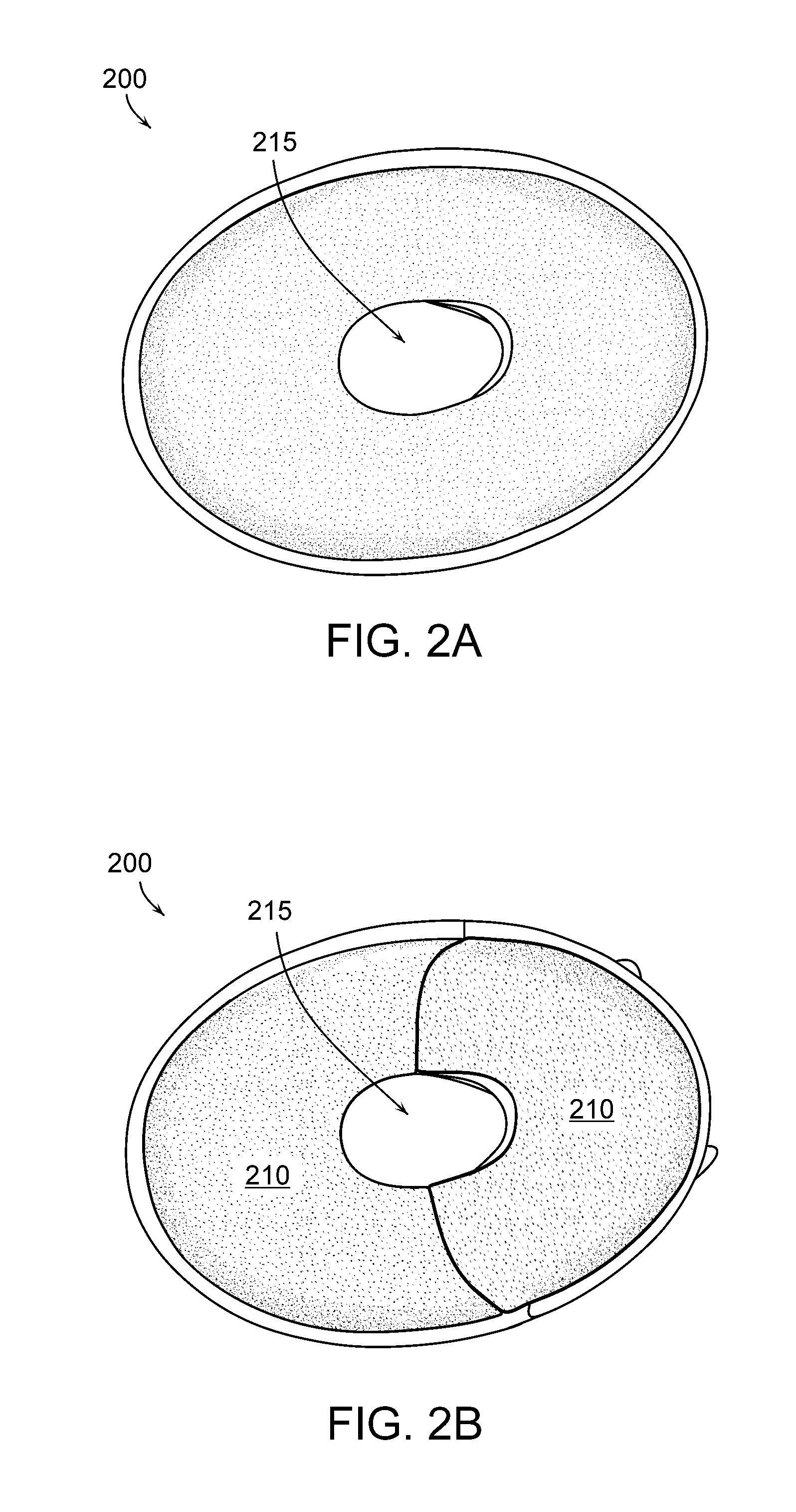 Modular implantable medical device