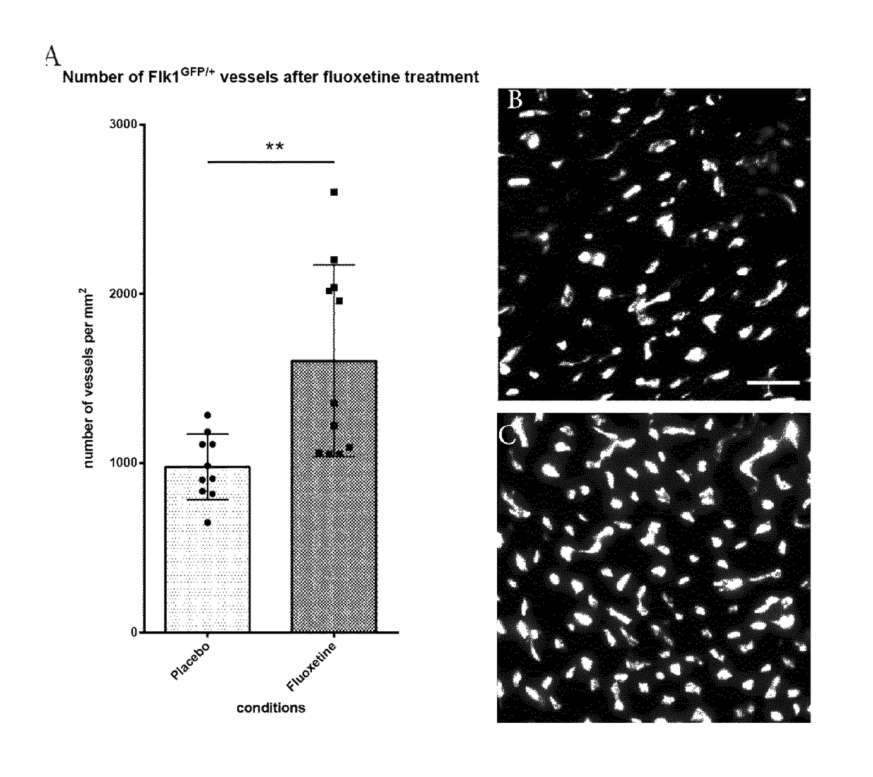 5-hydroxytryptamine 1b receptor-stimulating agent for the treatment of myocardial infarction