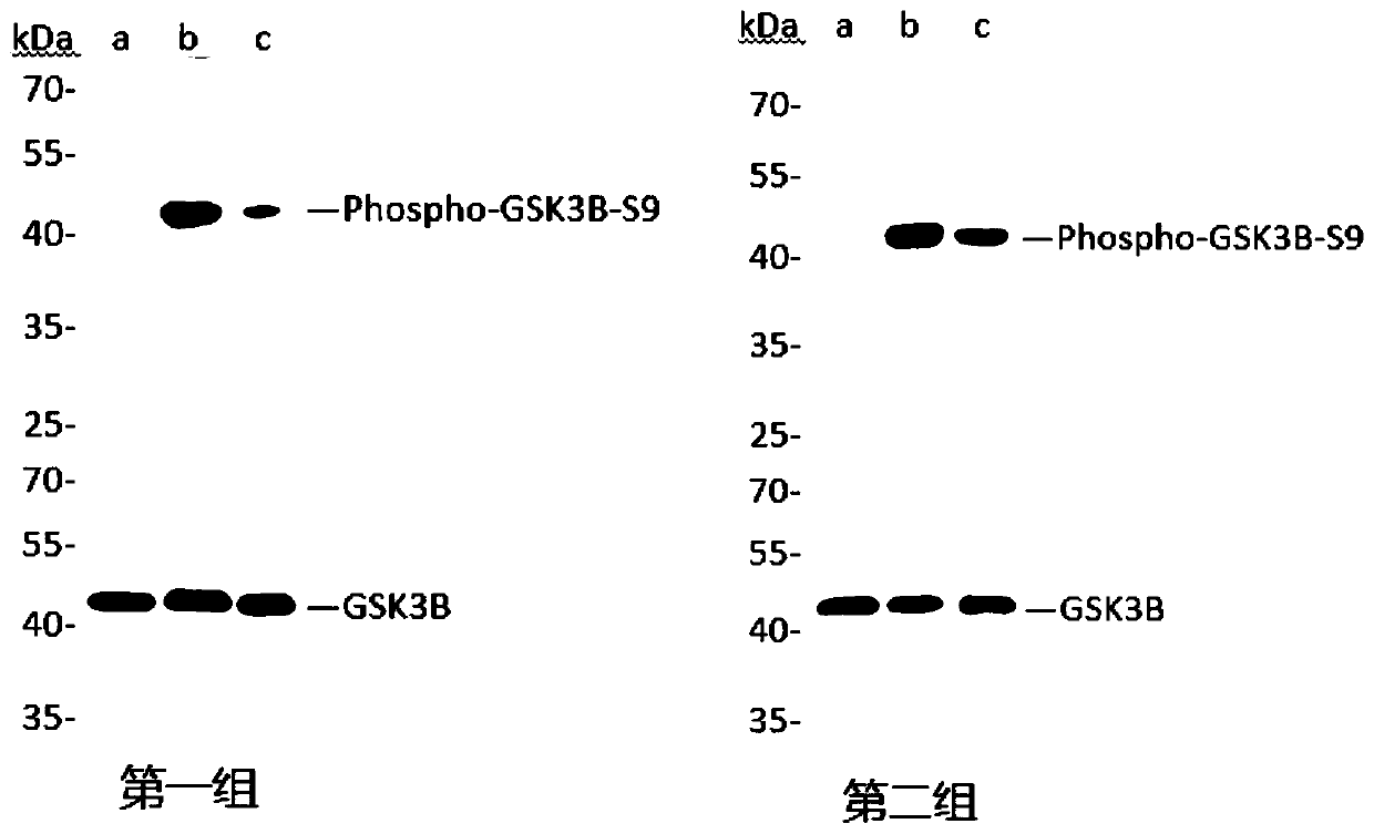 Method for preparing ATP in vitro phosphorylation sample