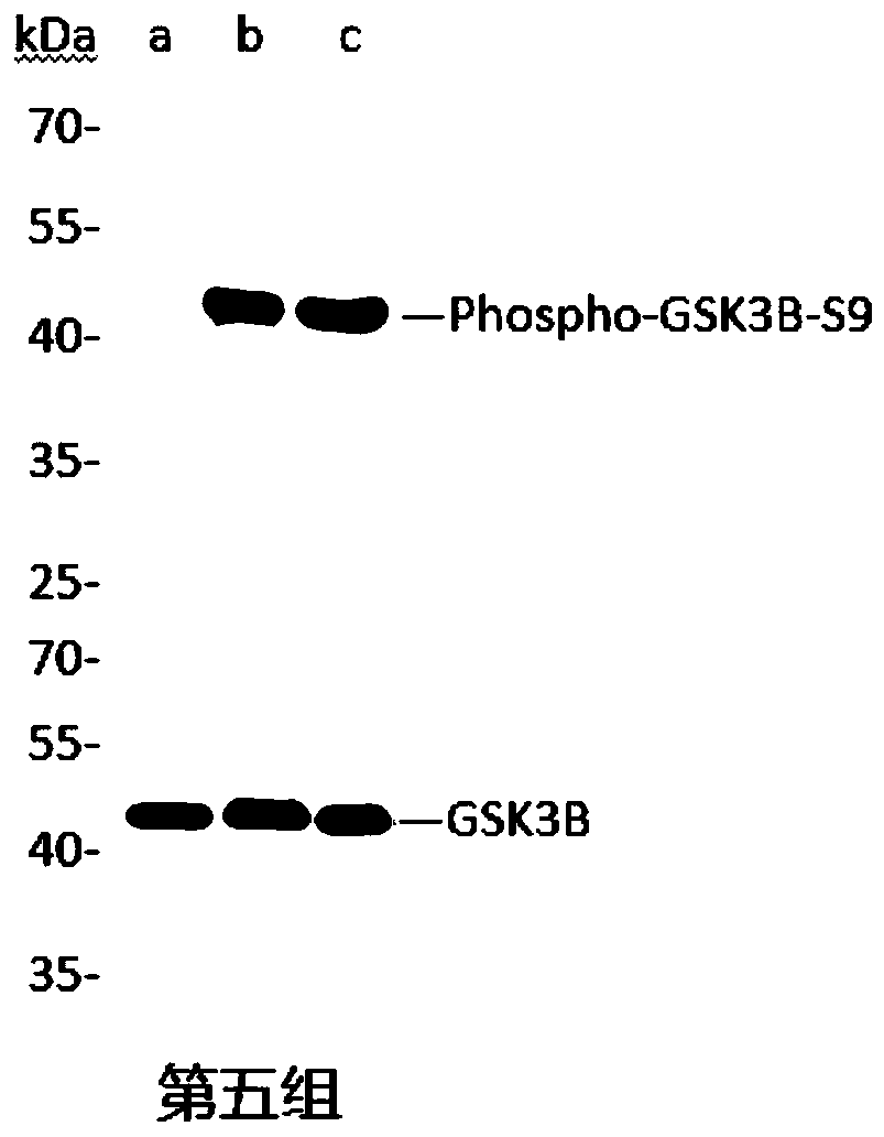 Method for preparing ATP in vitro phosphorylation sample