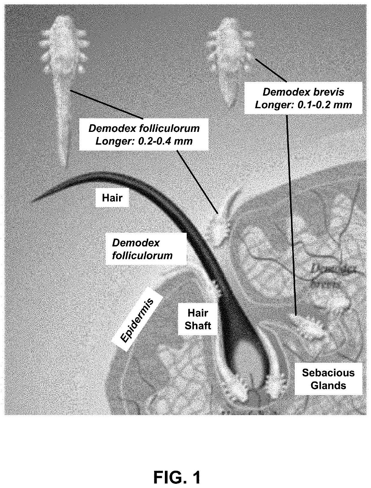 Anti-parasitic compounds for the treatment and prevention of viral diseases