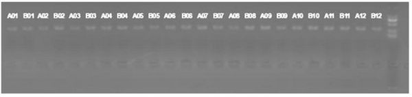 Methylation site in the promoter region of eno1 gene and its application in the preparation of kits for early diagnosis and prognosis evaluation of esophageal cancer