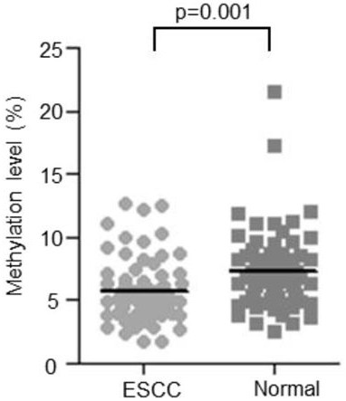 Methylation site in the promoter region of eno1 gene and its application in the preparation of kits for early diagnosis and prognosis evaluation of esophageal cancer