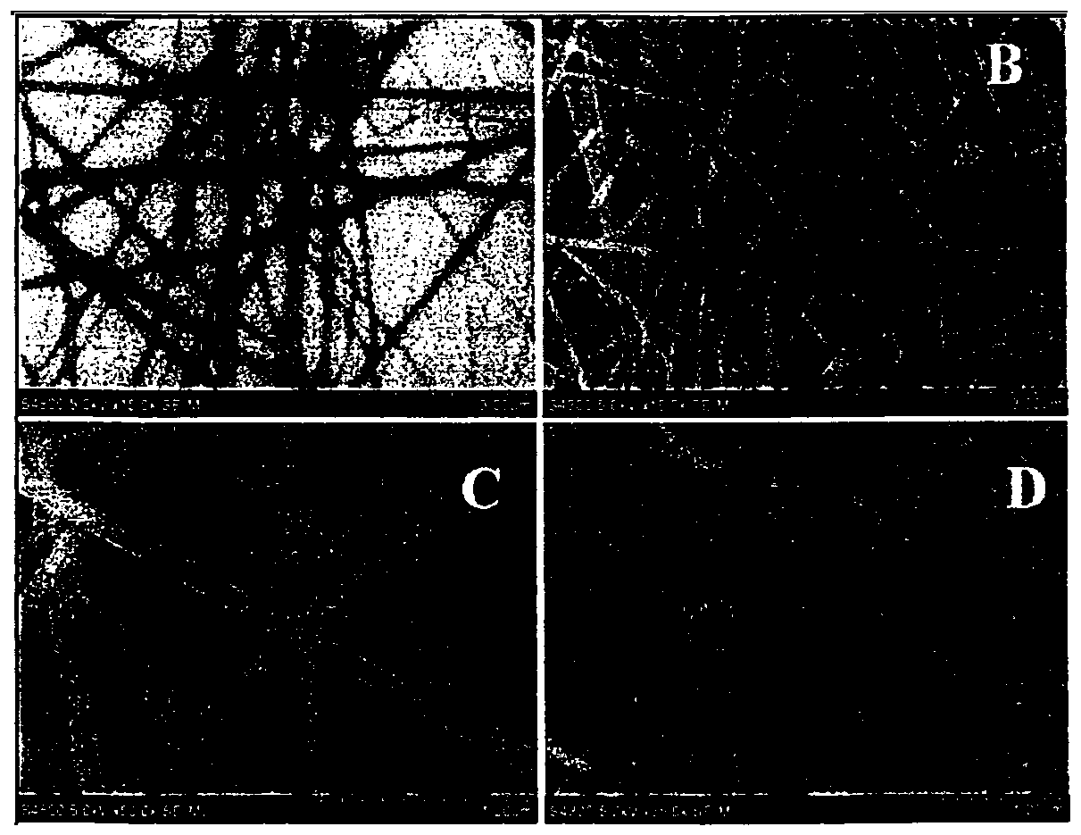 Preparation method of tissue engineering skin