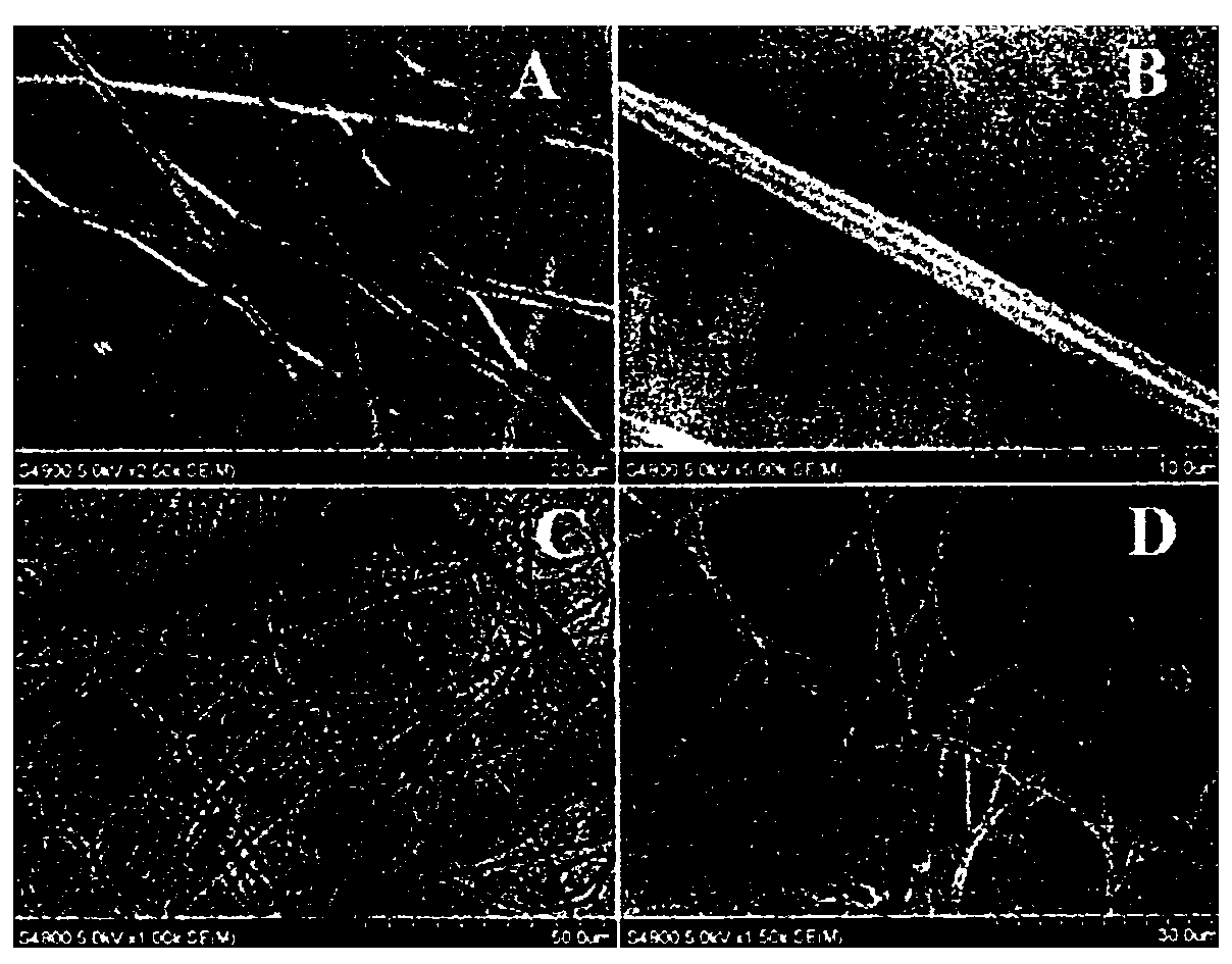 Preparation method of tissue engineering skin