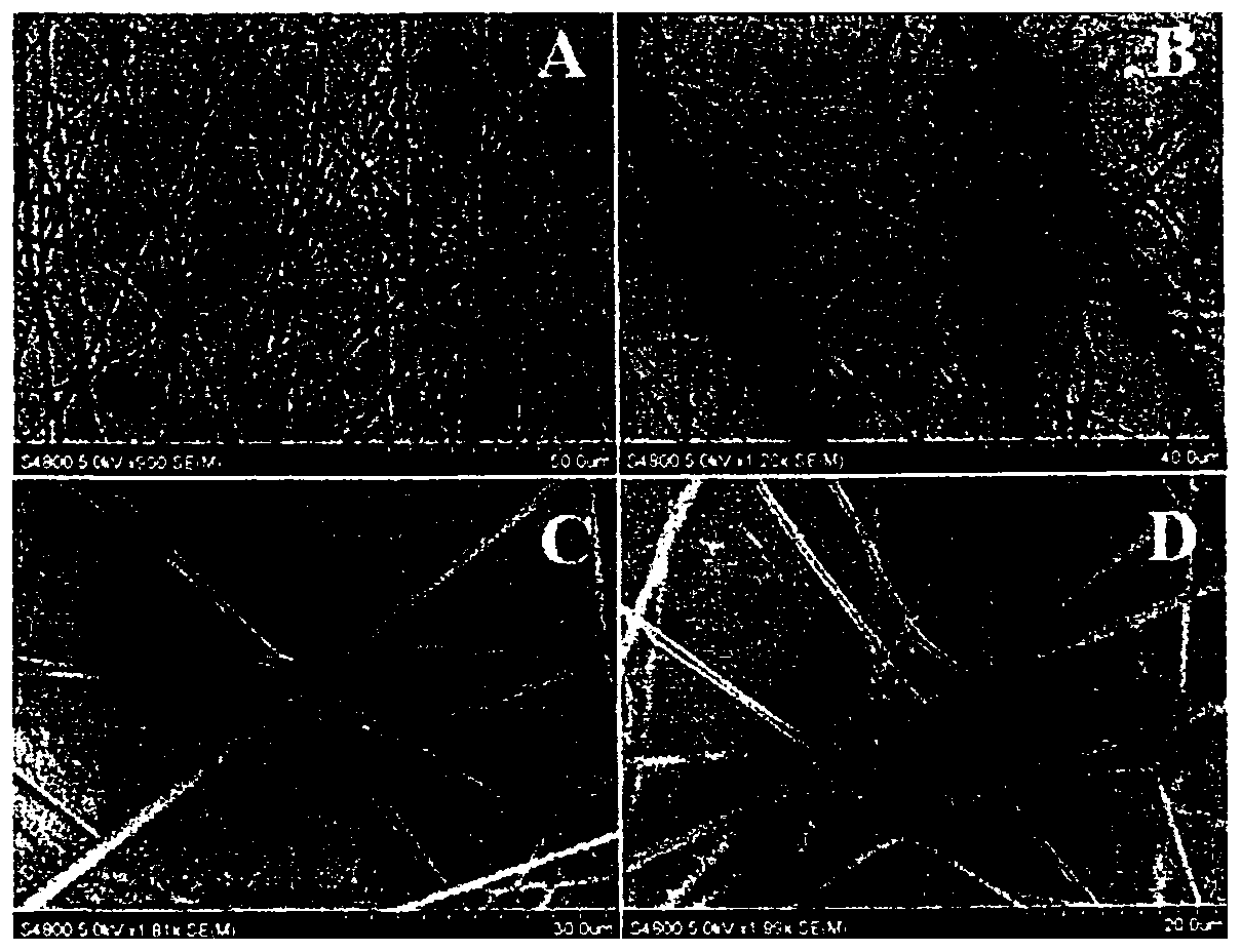 Preparation method of tissue engineering skin