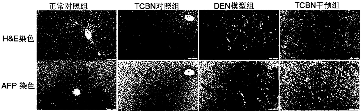 Inhibiting effect of AKT inhibitor on experimental rat hepatocellular carcinoma