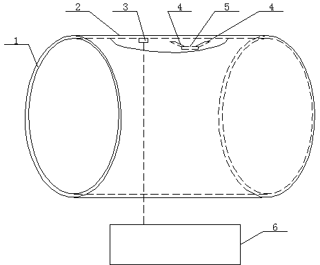 Remote control built-in internal arteriovenous fistula maturing using device and operating principle thereof