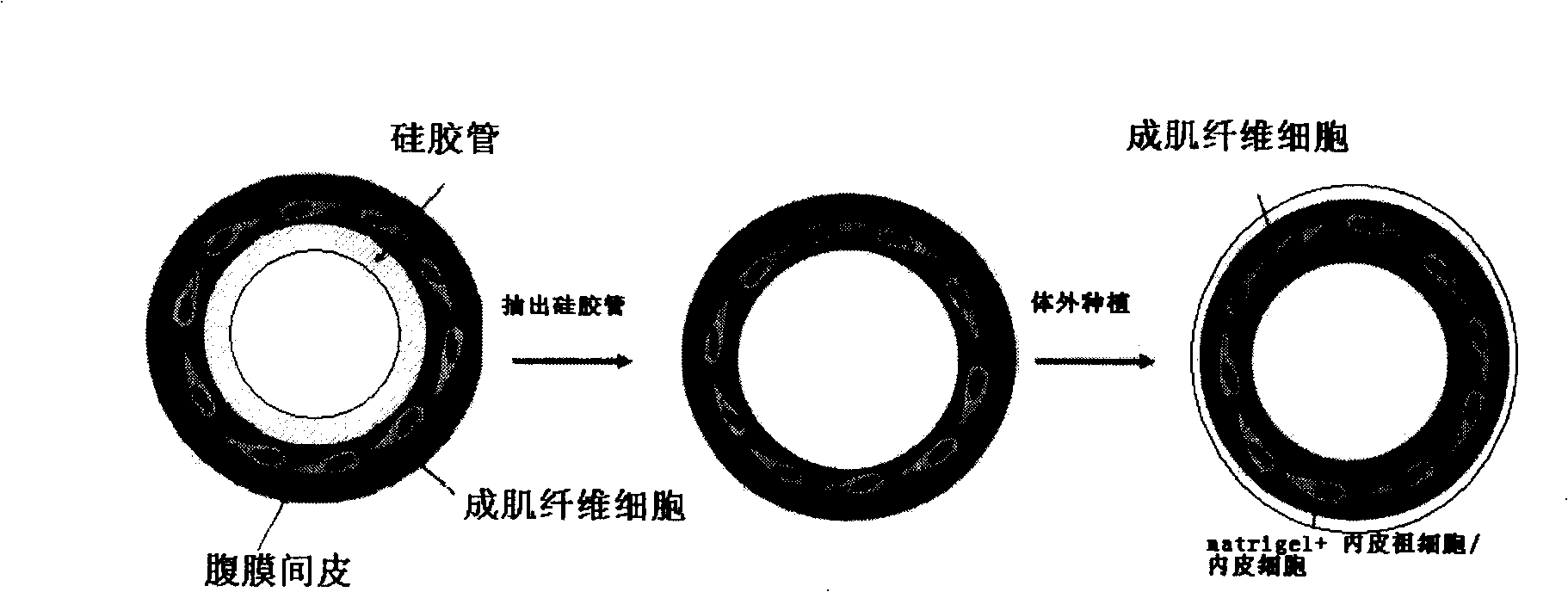 Construction method of tissue engineering blood vessel