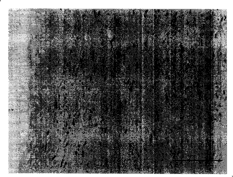 Construction method of tissue engineering blood vessel