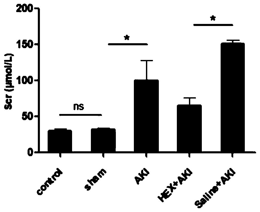 Application of hexarelin to preparing kidney ischemia reperfusion injury protecting drugs/drug combinations