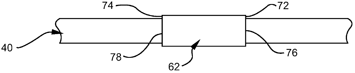 Bi-directional cannula feature capture mechanism