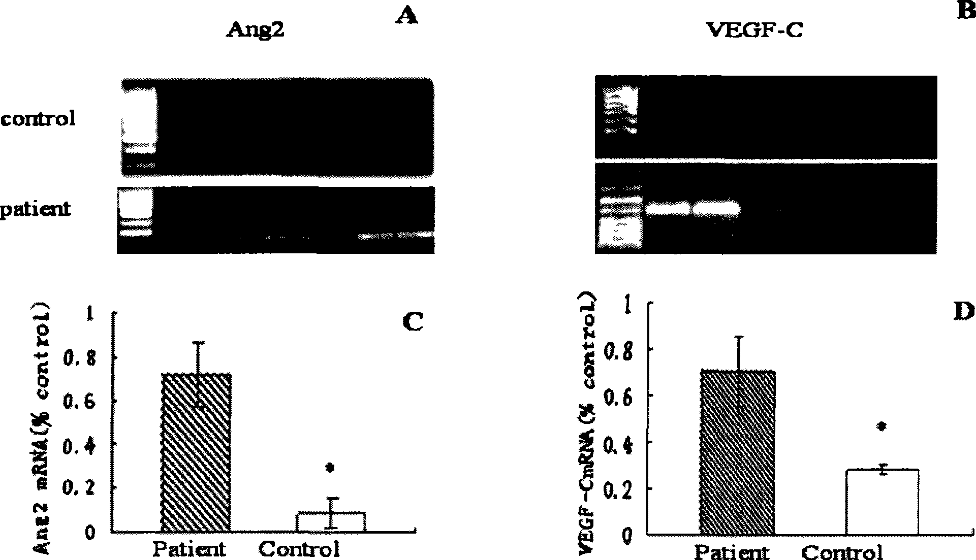 Application of Ang-2 and genes thereof in pharmacy