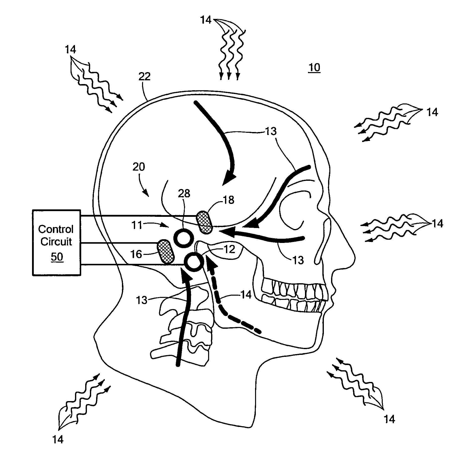 Hearing protection system