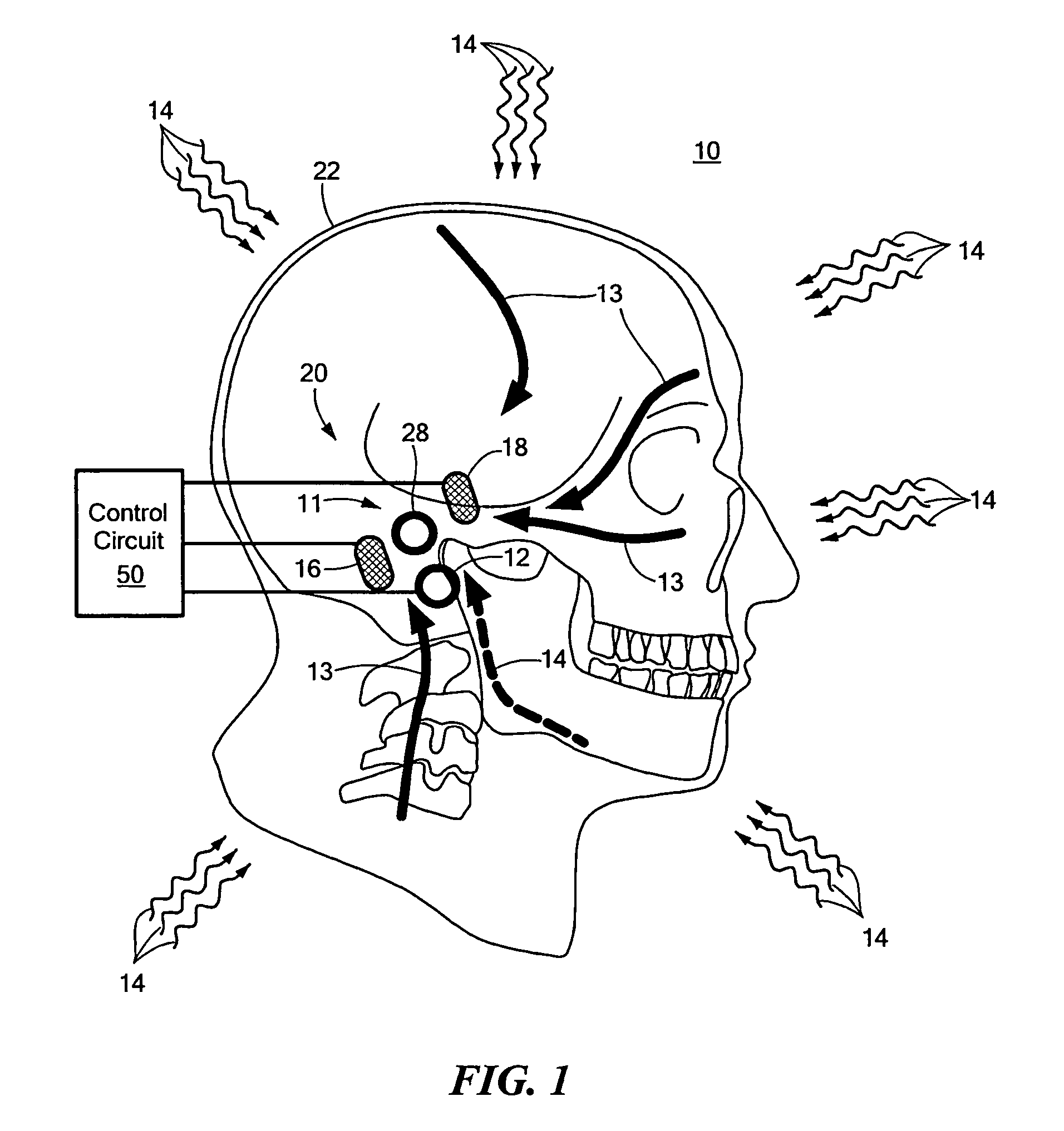 Hearing protection system