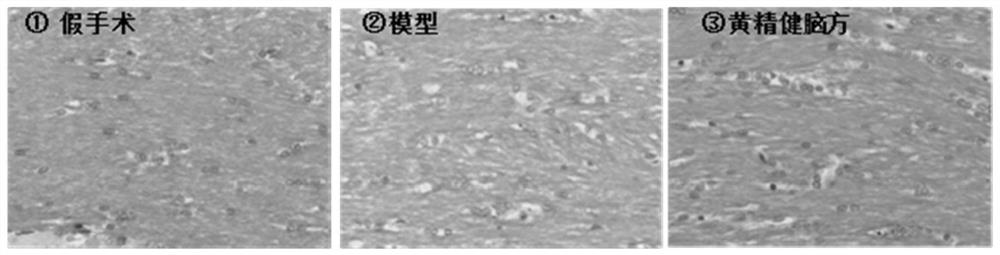 Traditional Chinese medicine composition for treating leukoencephalopathy and application thereof