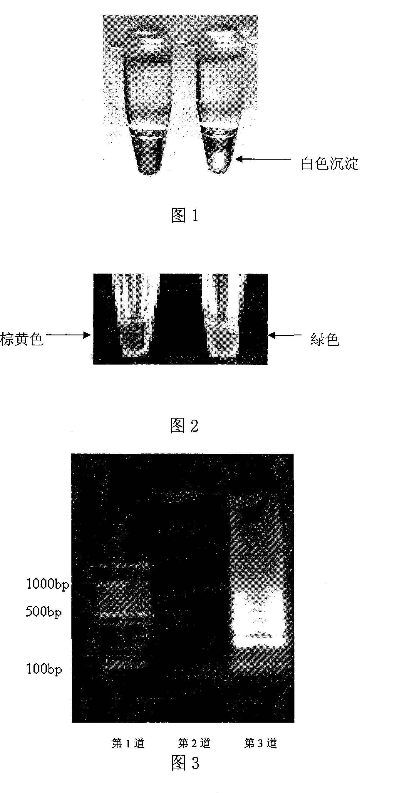 Method for detecting food-borne enterocolitisyersinia genus by loop-mediated isothermal amplification