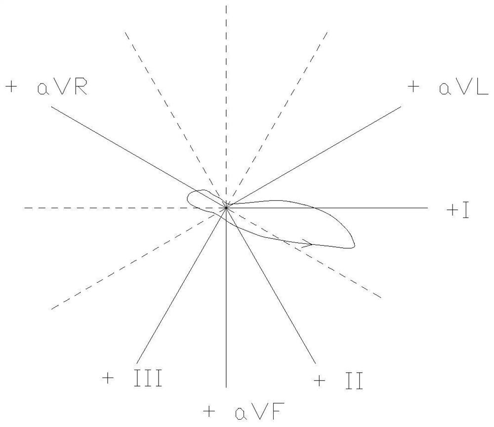 ECG teaching equipment