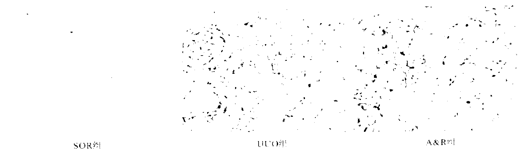 Medicine composite for treating chronic kidney diseases and preparation method and application of medicine composite