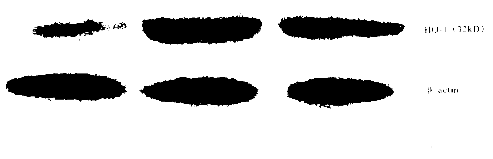 Medicine composite for treating chronic kidney diseases and preparation method and application of medicine composite