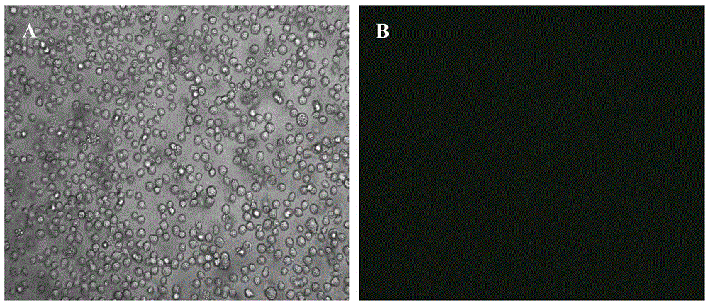 MDS (myelodysplastic syndrome) transfection leukocyte line with capacity of stable expression of GFP (green fluorescent protein)