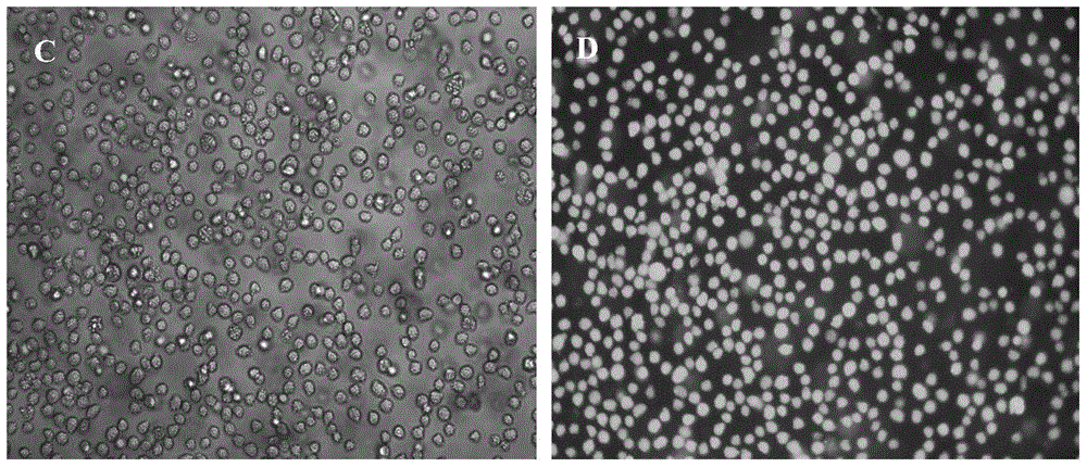 MDS (myelodysplastic syndrome) transfection leukocyte line with capacity of stable expression of GFP (green fluorescent protein)