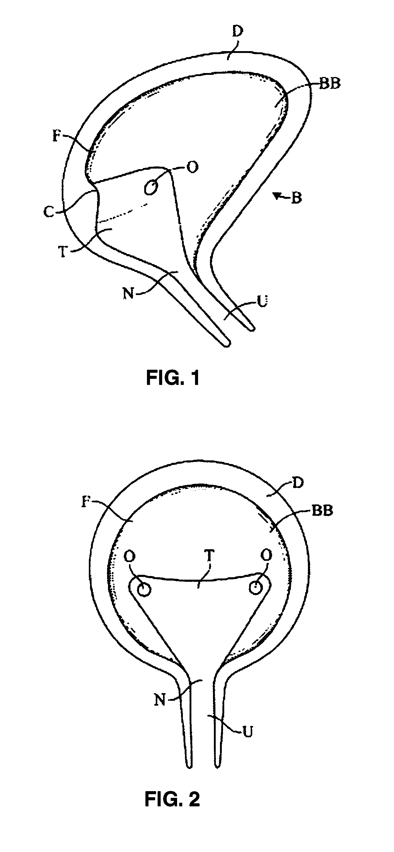 Methods And Devices For Treating Pelvic Conditions