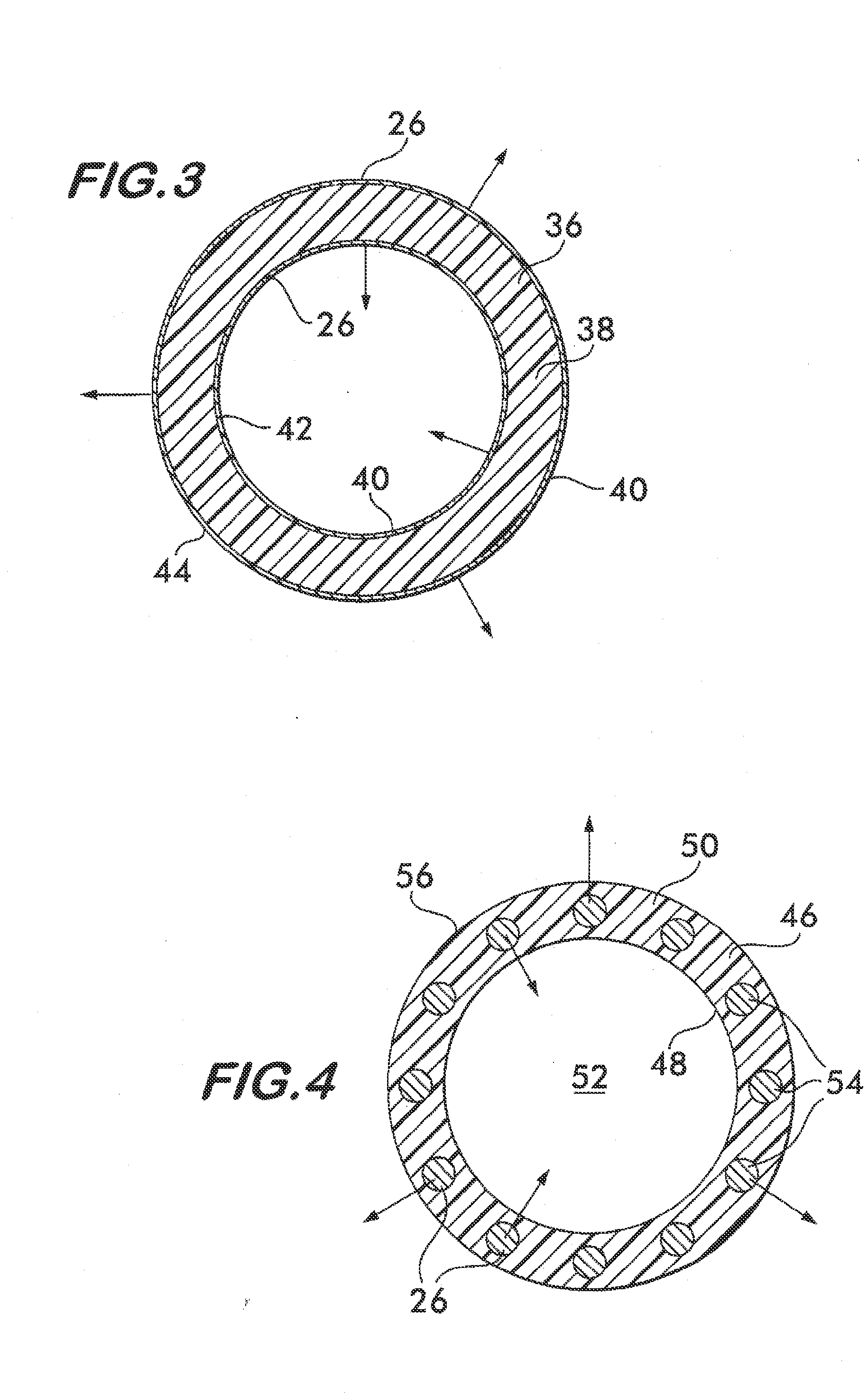 Implantable shunt or catheter enabling gradual delivery of therapeutic agents