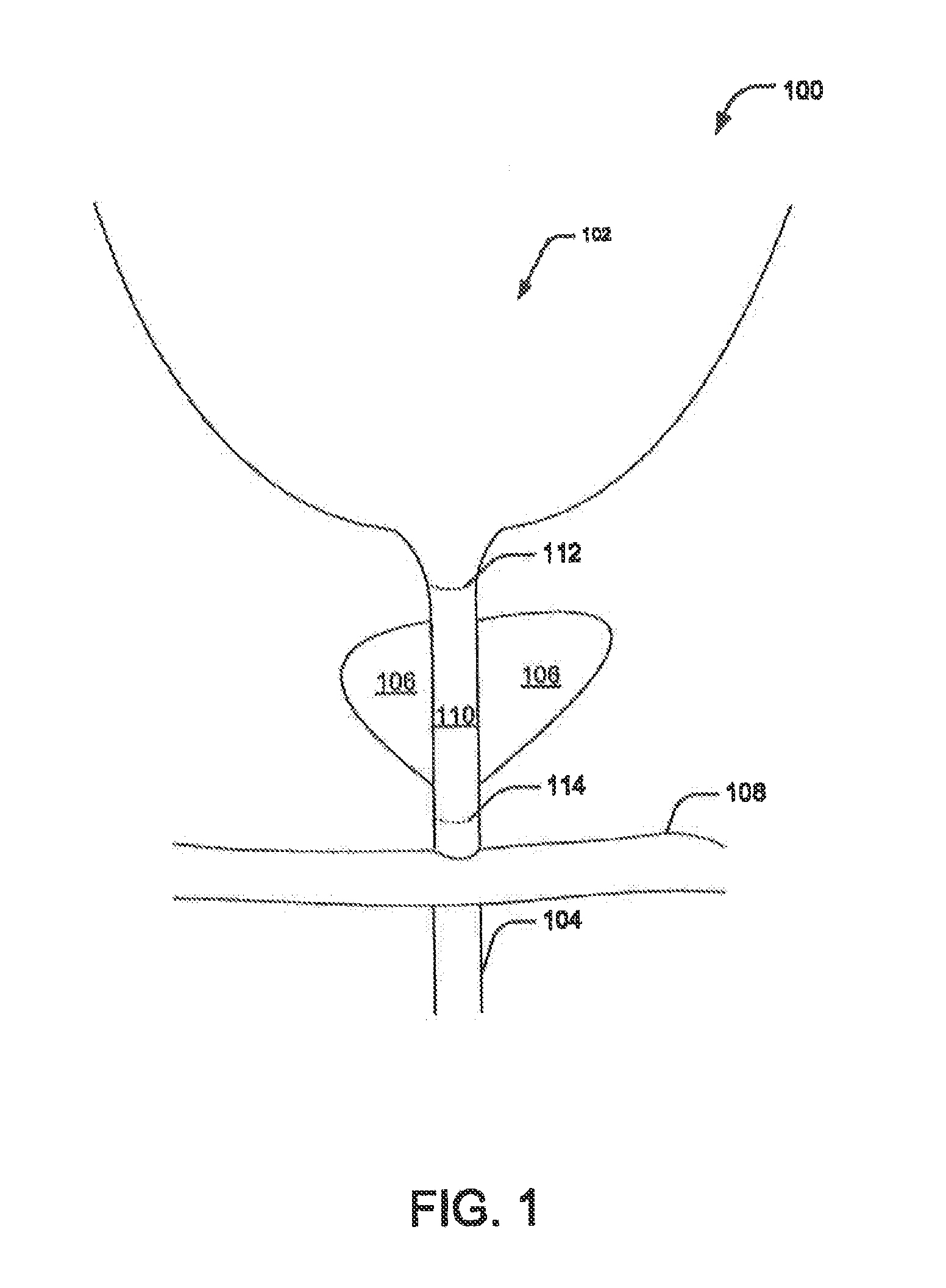 Pre-Positioned Anastomosis Device and Related Methods of Use