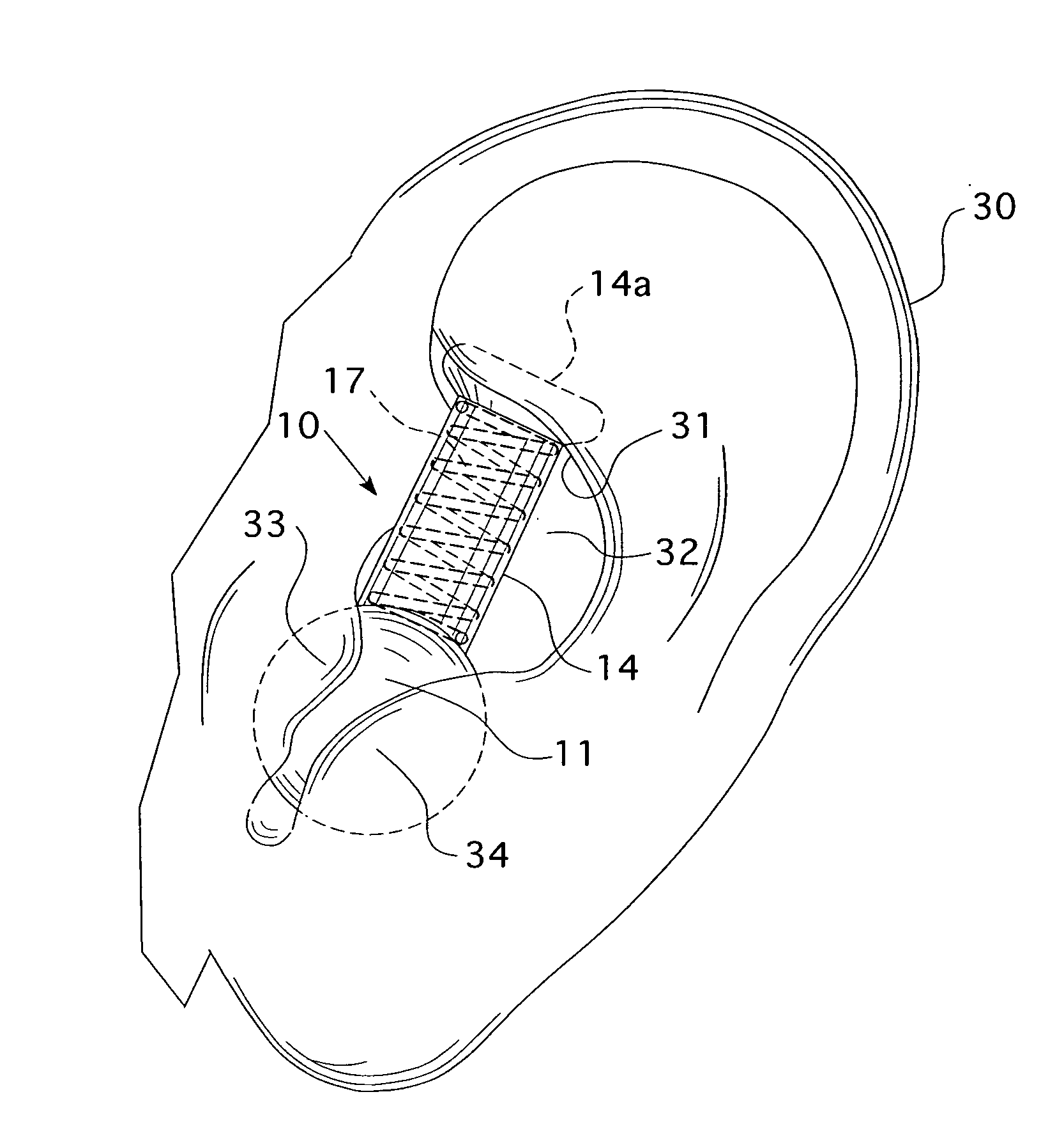 In ear communications device and stabilizer