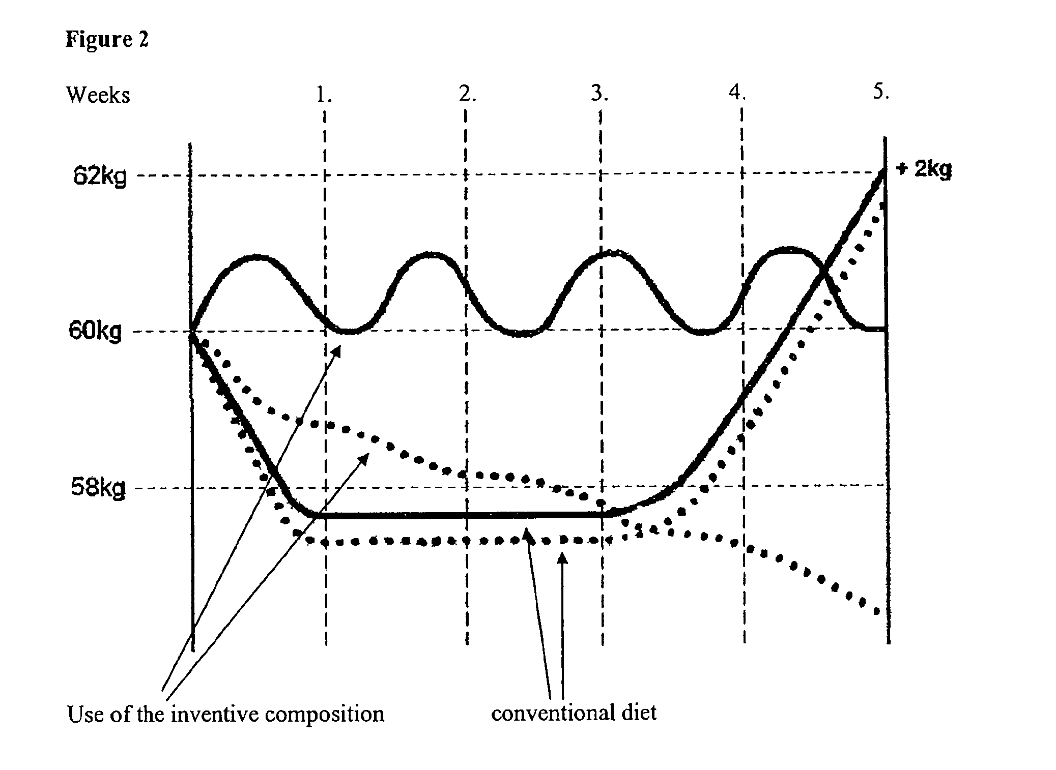 Preparation for reducing and/or preventing body fat and respective uses, in particular together with a dressing material