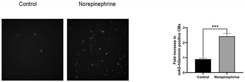 Pharmaceutical new use of norepinephrine