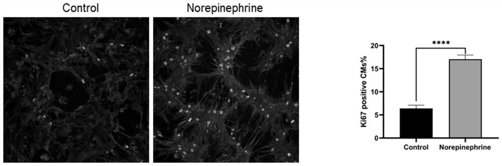 Pharmaceutical new use of norepinephrine